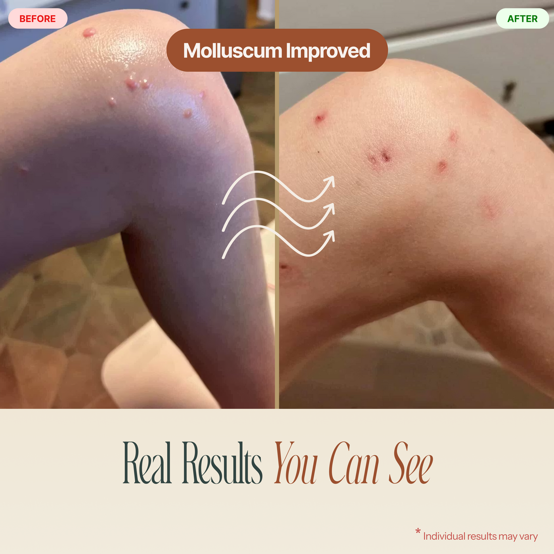 Ozonated Lymphatic Salve