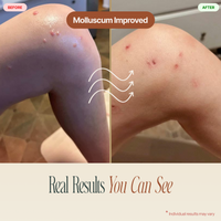 Ozonated Lymphatic Salve